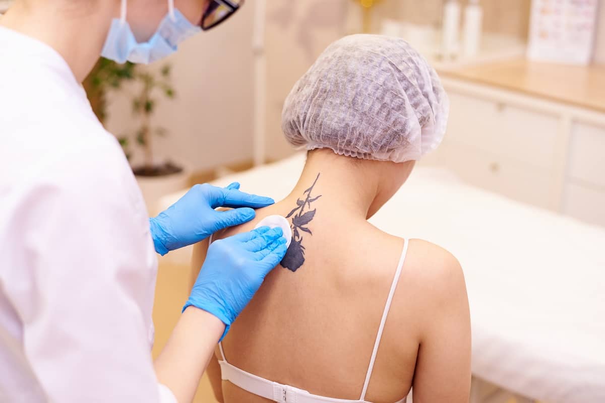 Laser tattoo removal in a cosmetology clinic.